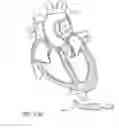 Fig. 97 - Nonstented temporary valve for cardiovascular therapy