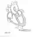 Fig. 99 - Nonstented temporary valve for cardiovascular therapy