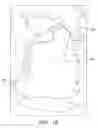Fig. 13 - Method for Making a Bicuspid Pulmonary Heart Valve