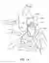 Fig. 15 - Method for Making a Bicuspid Pulmonary Heart Valve