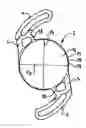 Fig. 01 - Intraocular Lens