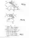 Fig. 02 - Intraocular Lens