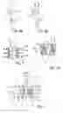 Fig. 04 - Implant, implantation device, implantation method