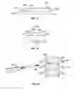 Fig. 07 - Joint arthroplasty devices having articulating members