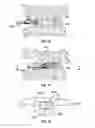 Fig. 08 - Joint arthroplasty devices having articulating members