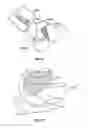 Fig. 24 - Joint arthroplasty devices having articulating members