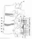 Fig. 01 - Implant for alleviating pressure on intervertebral disks and method for restoring the height of and alleviating pressure on an intervertebral space