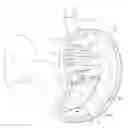 Fig. 01 - Expanding adhesive foam structure to reduce stomach volume