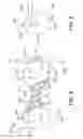 Fig. 07 - Pyloric obesity valve