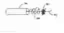 Fig. 01 - Fiber based embolism protection device