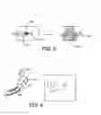Fig. 03 - Fiber based embolism protection device