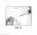 Fig. 17 - Fiber based embolism protection device