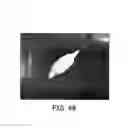 Fig. 21 - Fiber based embolism protection device