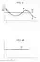 Fig. 05 - Method and apparatus for accurately determining height coordinates in a satellite/laser positioning system