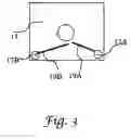Fig. 04 - Means and methods for lifting fringed garments