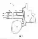 Fig. 02 - Vacuum trimmer