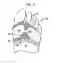 Fig. 07 - Protective foot covering