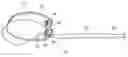 Fig. 01 - Tree Support Device