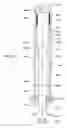 Fig. 33 - Apparatus and methods for drilling a wellbore using casing