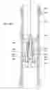 Fig. 43 - Apparatus and methods for drilling a wellbore using casing