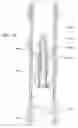Fig. 45 - Apparatus and methods for drilling a wellbore using casing