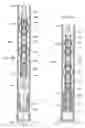 Fig. 46 - Apparatus and methods for drilling a wellbore using casing