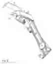 Fig. 08 - Removable lever assembly for fluid dispenser