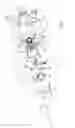 Fig. 06 - Valve unit with a sliding throttle-chamber and circuit comprising a valve