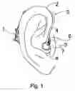 Fig. 02 -  METHOD AND A TOOL FOR SHAPING AN ELONGATED DEFORMABLE MEMBER FOR A HEARING AID
