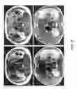 Fig. 09 - Echo train preparation for fast spin-echo acquisition