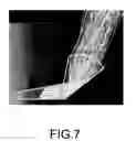 Fig. 07 - Light guide, light source apparatus, and electronic apparatus