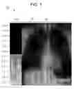 Fig. 02 - Systems and methods for an interactive PACS image display test image