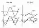 Fig. 17 - Correlation operation method, correlation operation device, focus detection device and imaging device