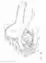 Fig. 03 - Surgical multiple use adhesive applier