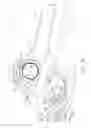 Fig. 05 - Surgical multiple use adhesive applier
