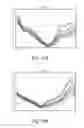 Fig. 17 - METHOD AND APPARATUS FOR ANALYTE MEASUREMENTS IN THE PRESENCE OF INTERFERENTS