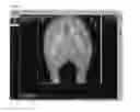 Fig. 07 - X-ray visible drug delivery device