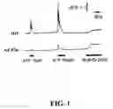 Fig. 02 - Methods of treating restenosis