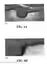 Fig. 08 - Methods and reagents for the enhancement of virus transduction in the bladder epithelium