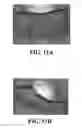 Fig. 22 - Methods and reagents for the enhancement of virus transduction in the bladder epithelium