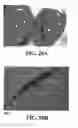 Fig. 41 - Methods and reagents for the enhancement of virus transduction in the bladder epithelium