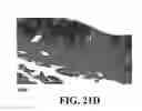 Fig. 44 - Methods and reagents for the enhancement of virus transduction in the bladder epithelium