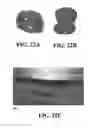 Fig. 45 - Methods and reagents for the enhancement of virus transduction in the bladder epithelium