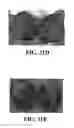 Fig. 64 - Methods and reagents for the enhancement of virus transduction in the bladder epithelium