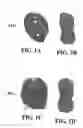 Fig. 02 - Methods and reagents for the enhancement of virus transduction in the bladder epithelium