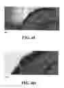 Fig. 09 - Methods and reagents for the enhancement of virus transduction in the bladder epithelium