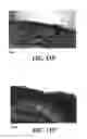 Fig. 28 - Methods and reagents for the enhancement of virus transduction in the bladder epithelium