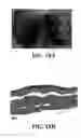 Fig. 37 - Methods and reagents for the enhancement of virus transduction in the bladder epithelium