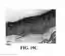 Fig. 40 - Methods and reagents for the enhancement of virus transduction in the bladder epithelium