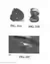 Fig. 43 - Methods and reagents for the enhancement of virus transduction in the bladder epithelium